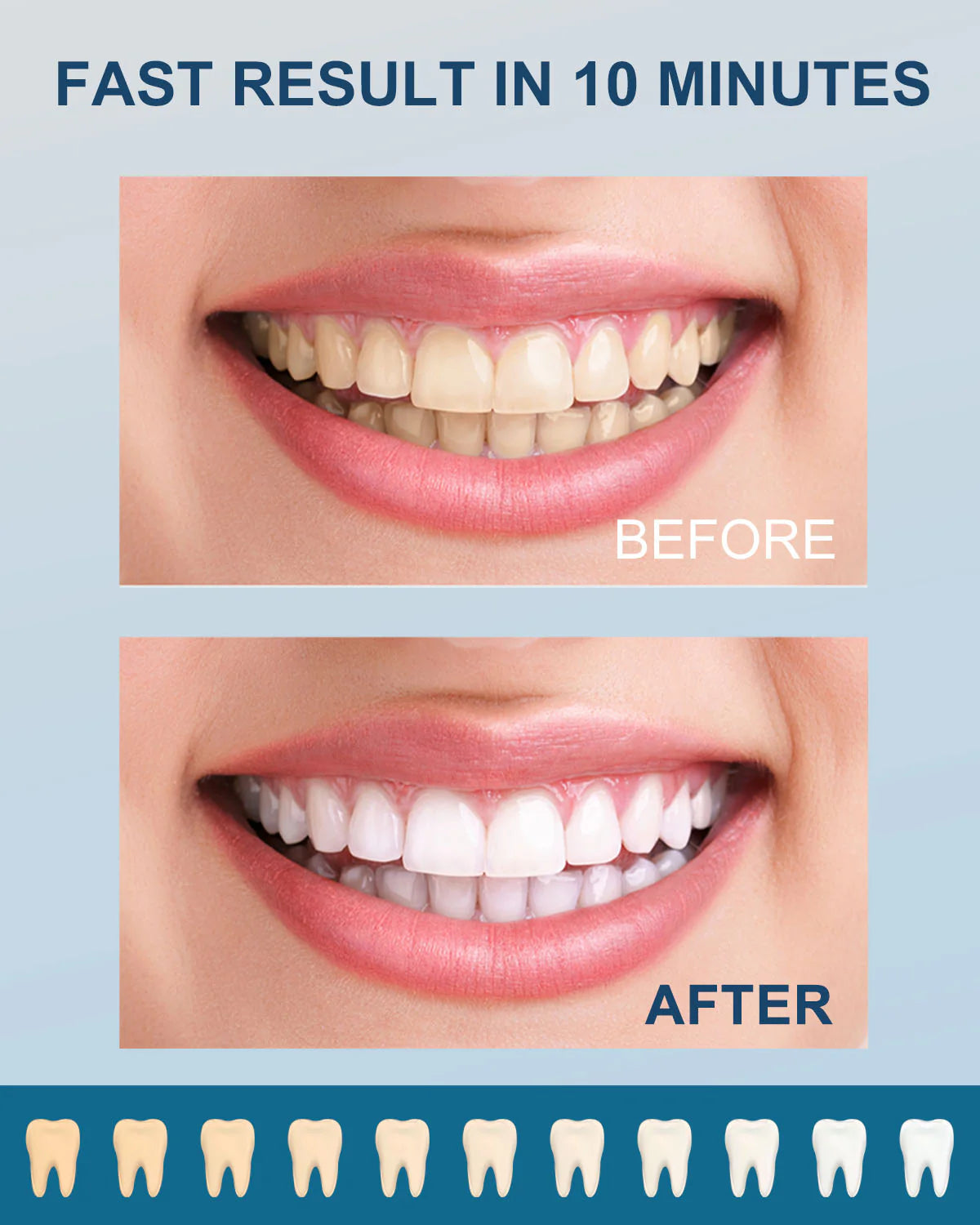 Blanqueador Dental WhitePro